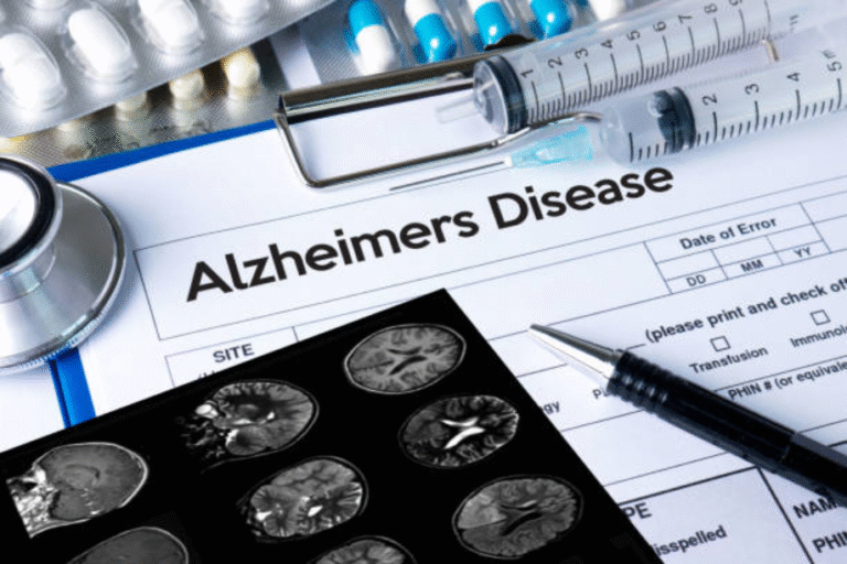 Specialized Alzheimer's Care in Houston for Safe & Reliable Assistance